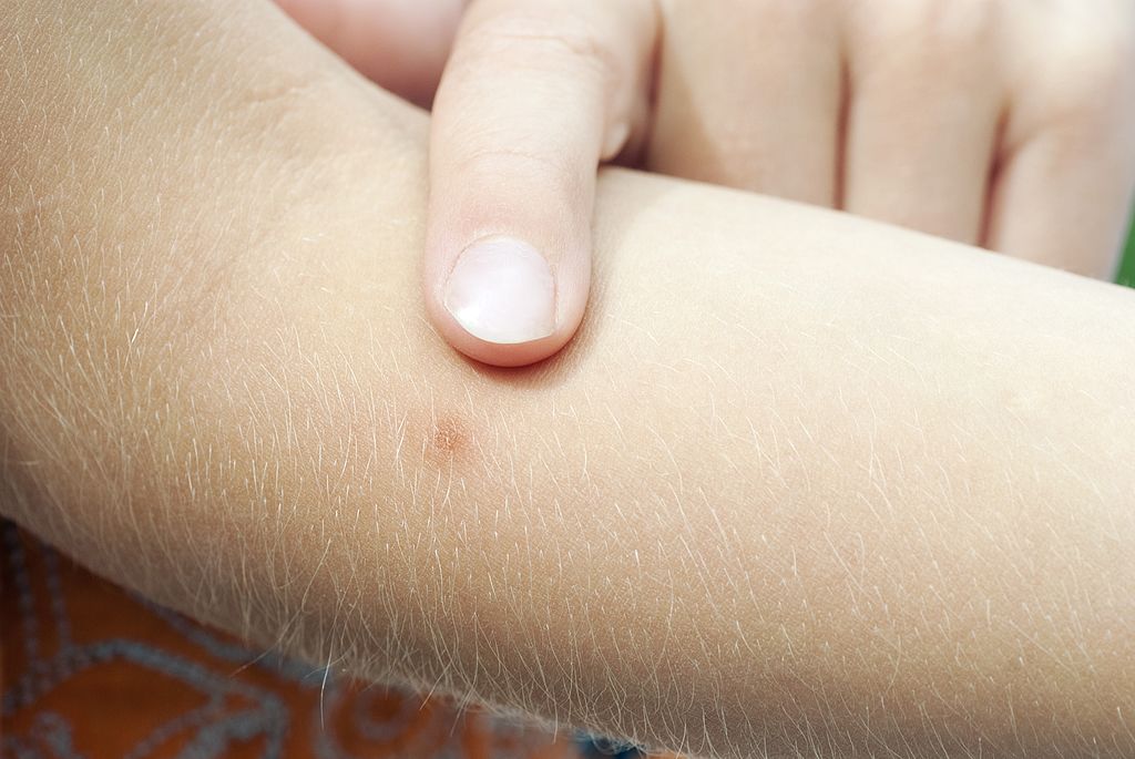 GettyImages-151052100