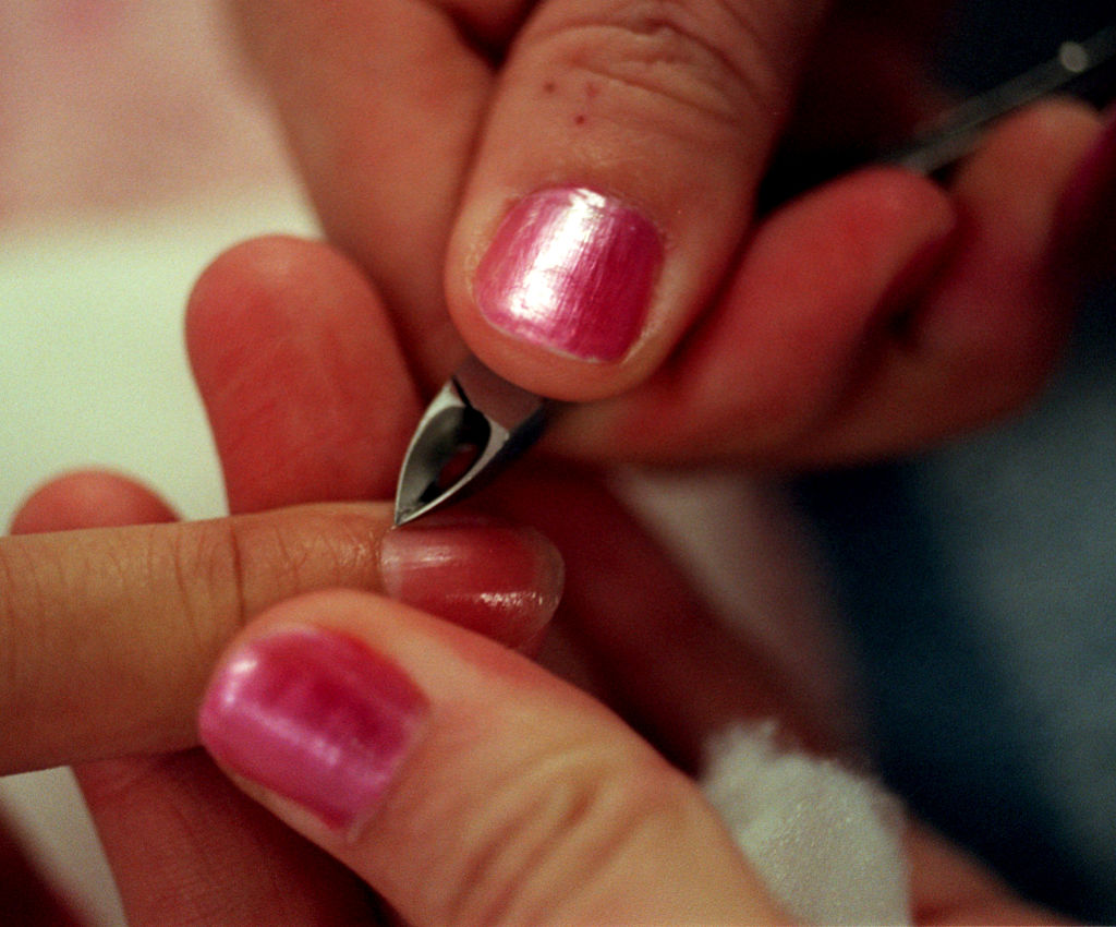 Cracked Cuticles
