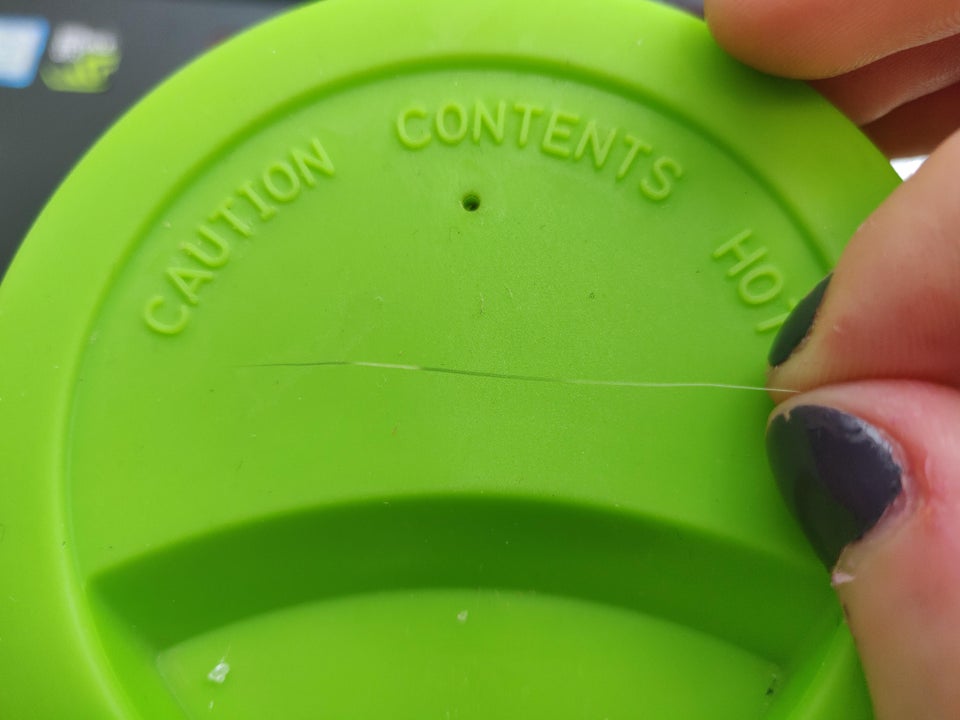 hair that is black and white stripes from medication