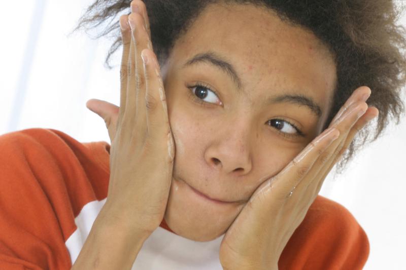 A teenage boy with acne applies exfoliating lotion.