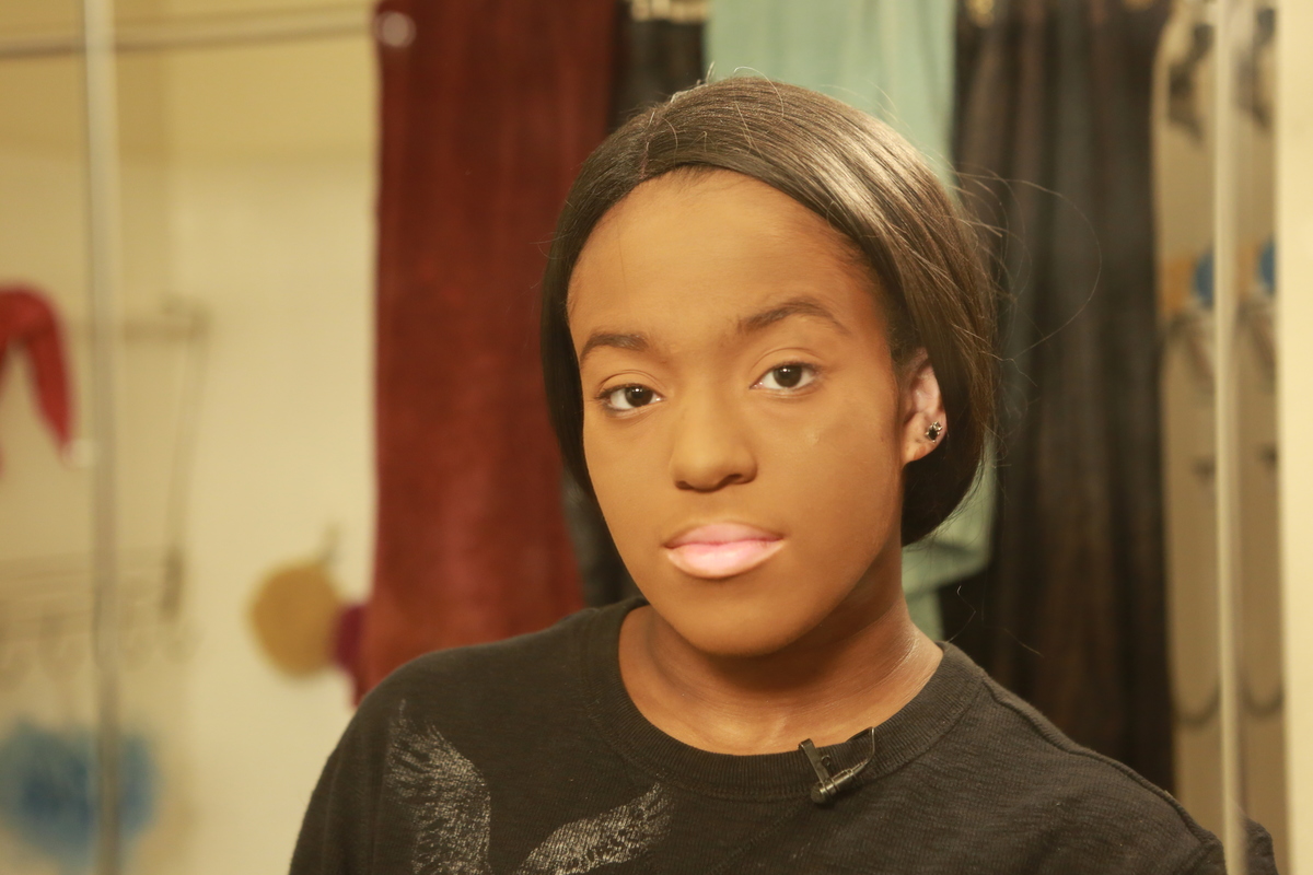 A woman's face is caked in makeup to cover up her vitiligo. 