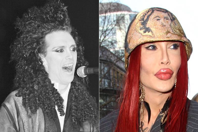 pete-burns-plastic-surgery