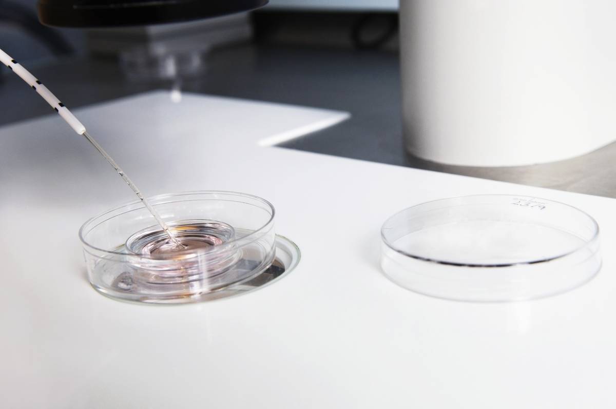 During the IVF process, embryos are being selected from a petri dish.