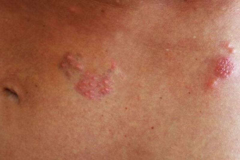 12 Renov Aloe Vera 25