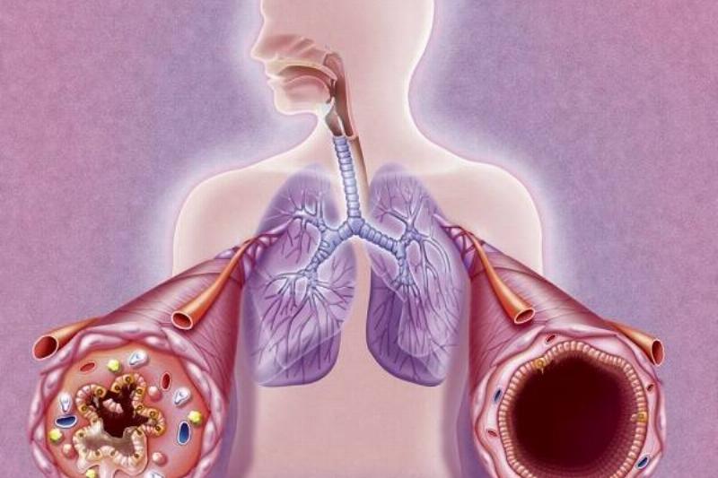 12 Renov Aloe Vera 29