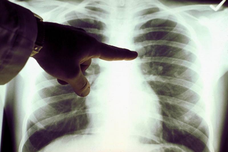 Cancer Images